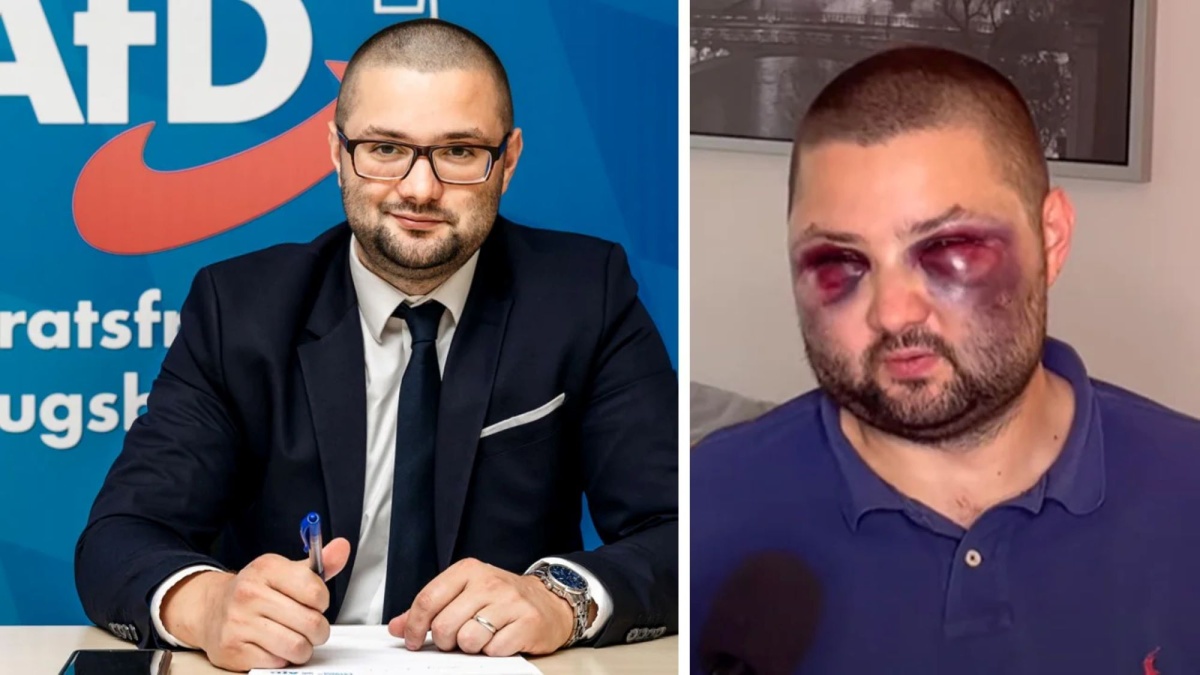 Politician român, desfigurat în bătaie în Germania